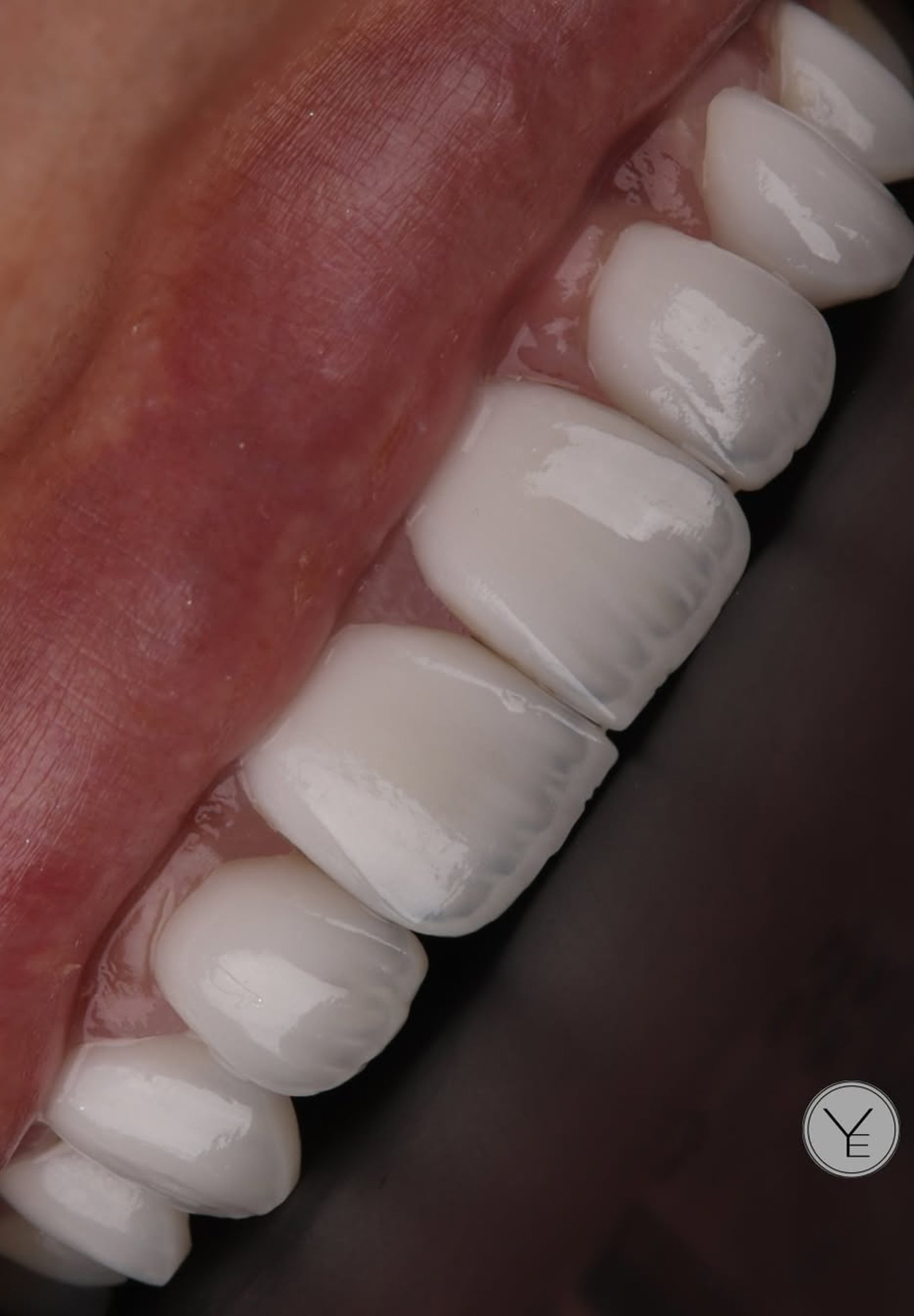 SnapInsta.to_536846251_18525213583018854_6503144625436941393_n